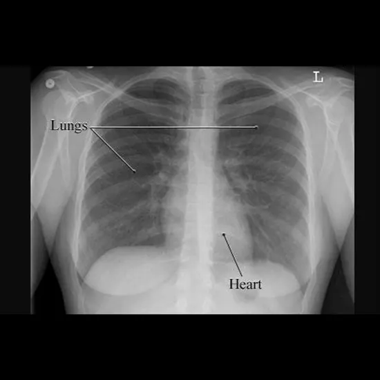 What Is The Role of X-Rays In Respiratory Health?